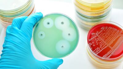 ENVI: Prescription Requirement Only With Evidence Of Antimicrobial Resistance