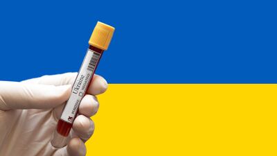 Ukraine’s Plea To Industry: Restart Clinical Trials And Give Us New ‘Weapons’ To Fight Cancer