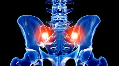 “We’re A Pain-Management Company.” Nevro Adds SI Joint Surgery To SCS Business