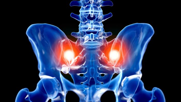 sacroiliac pain