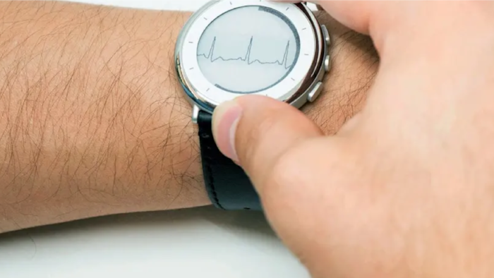 Zio Watch