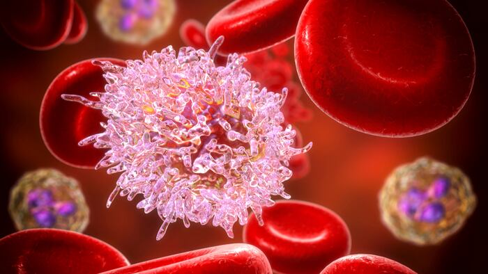Leukemia