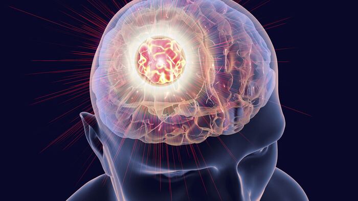 Tumour
