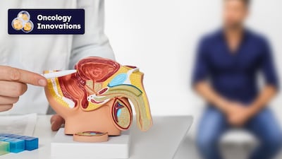 Vanquishing Prostate Cancer Without Debilitating Side Effects – Francis Medical CEO On Water Vapor Ablation