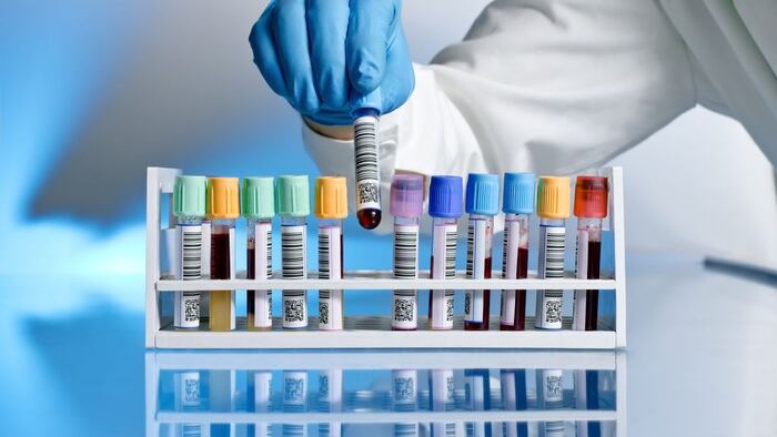 test tube