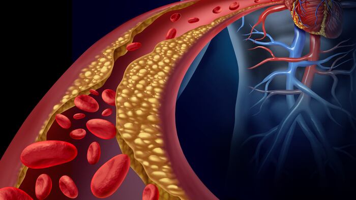 cholesterol _181632251_1200.jpg