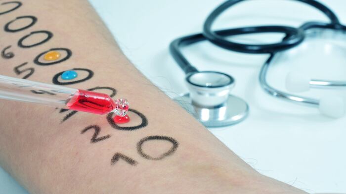 Allergy test
