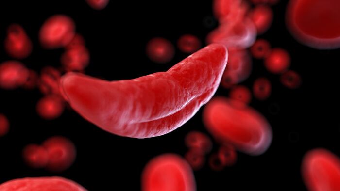 3d graphic of sickled blood cell