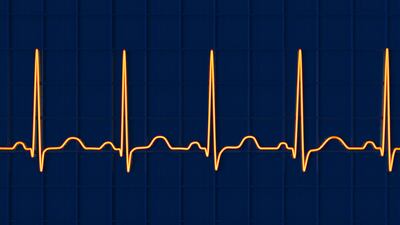 Medtronic Adds AI In Reveal Linq Device To Reduce False Alerts