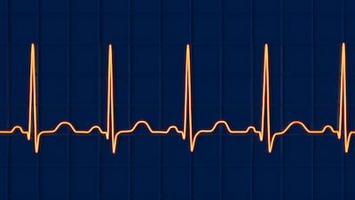 Medtronic Adds AI In Reveal Linq Device To Reduce False Alerts