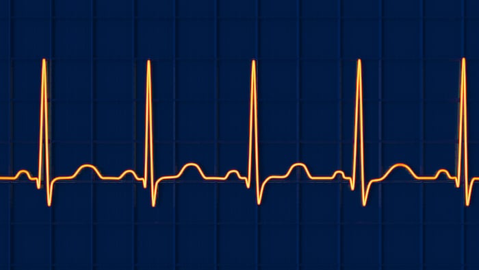 AFib
