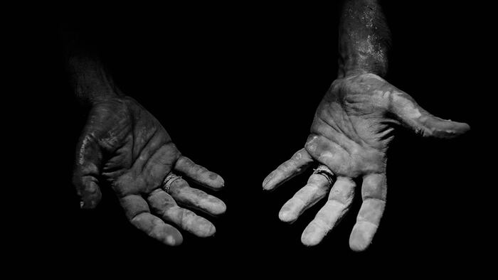Dirty hands