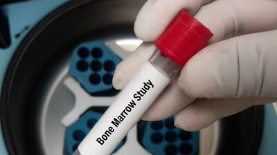 Israeli Company Lands De Novo Clearance For Digital Bone Marrow Application