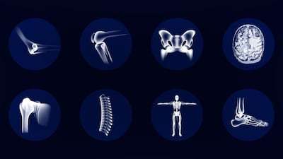 FDA Issues Draft Guidance On Premarket Submissions For Coated Orthopedic Devices