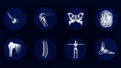 FDA Issues Draft Guidance On Premarket Submissions For Coated Orthopedic Devices