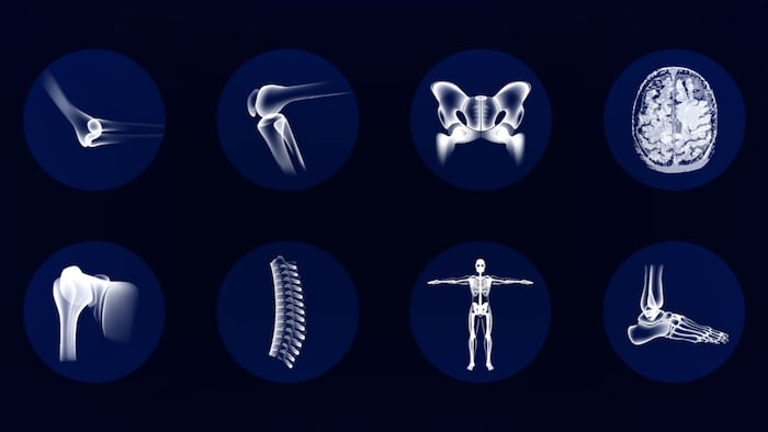 Orthopedic Joints