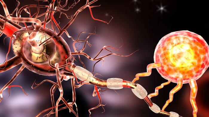 Multiple Sclerosis