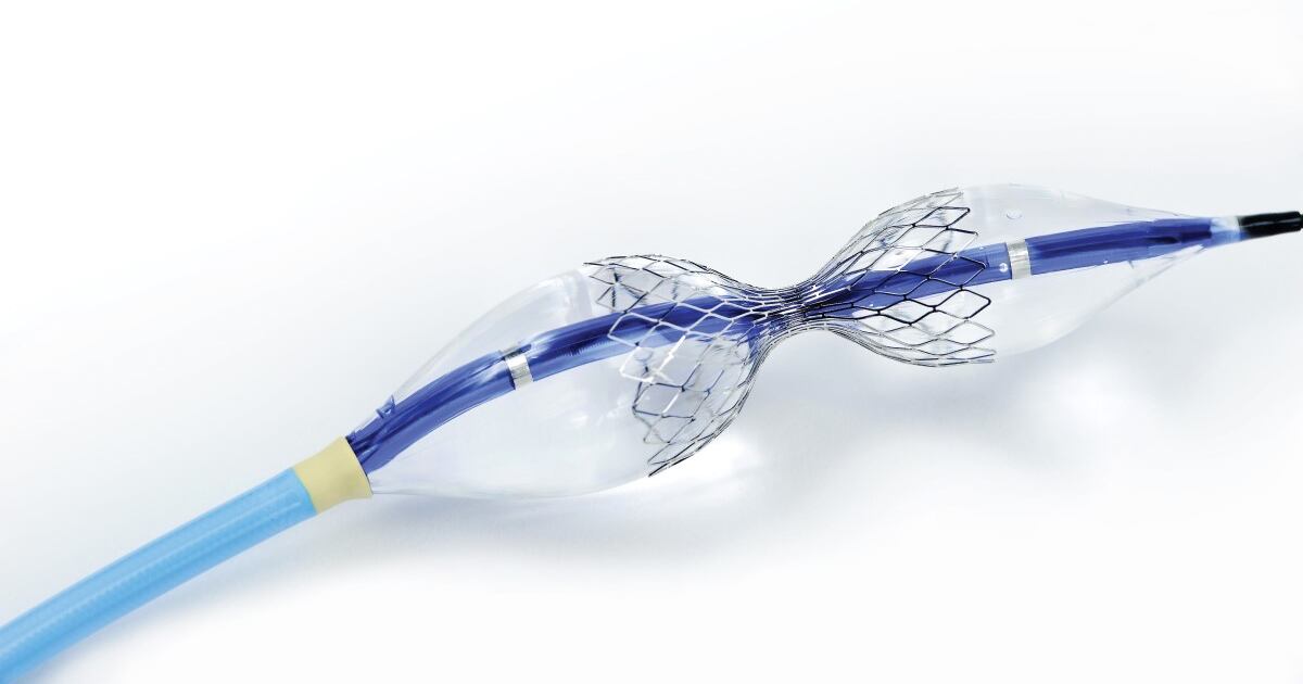 Hbw Insight Shockwave Buys Neovasc, Hoping Reducer Angina Device Complements ...