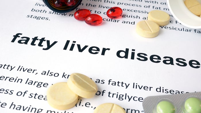SC2008_Fatty Liver_274834199_1200.jpg