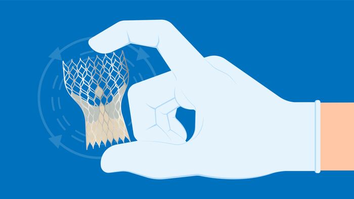 Transcatheter aortic valve replacement implantation TAVR TAVI minimally invasive surgery for treatment Aortic stenosis AS
