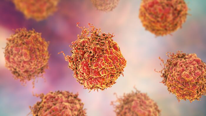 Prostate cancer