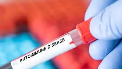 SciRhom Secures €63m Series A To Target Autoimmune Disease ‘Master Switch’
