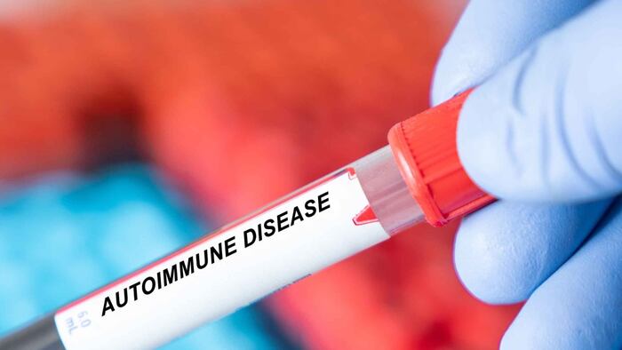 Autoimmune disease