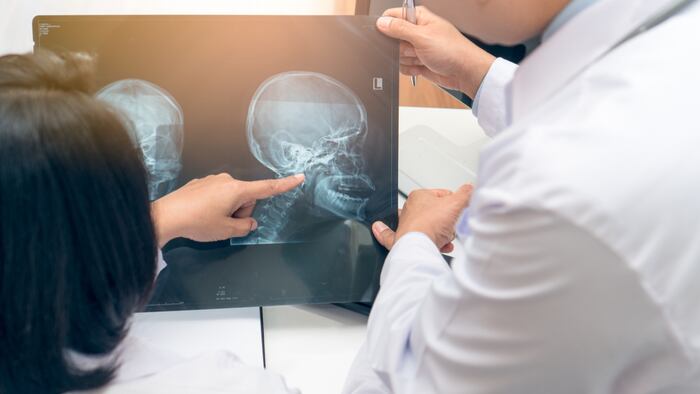 Brain Scan