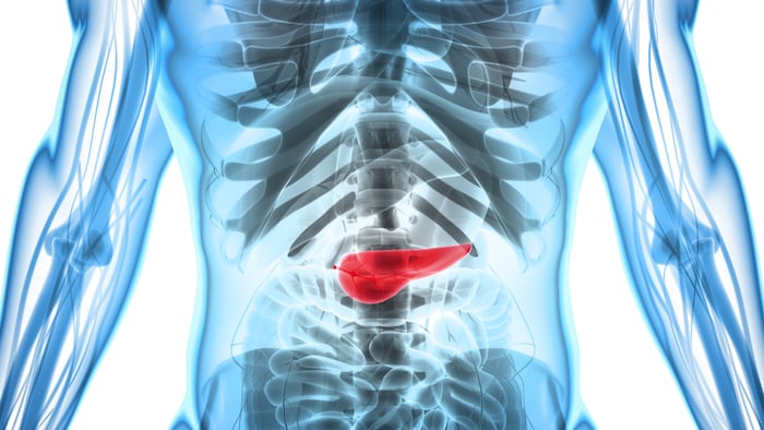 Pancreatic cancer