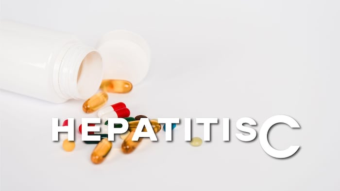 Hepatitis C