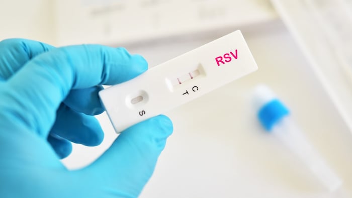 RSV test