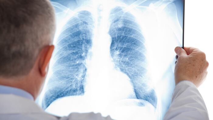Pulmonary disease