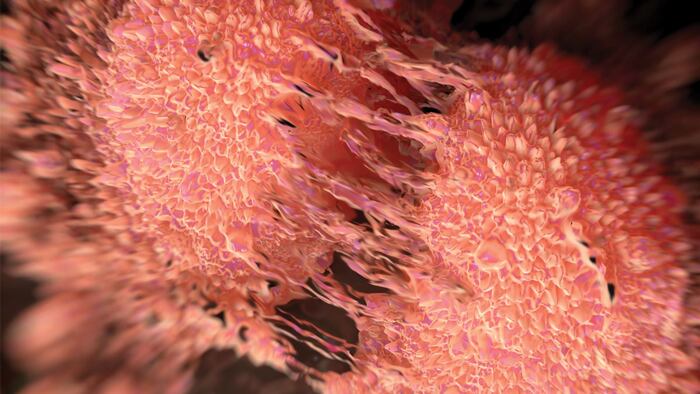 Cancer cell division of two prostate cancer cells in the final stage of cell division (cytokinesis) cytoplasm divides. the cells are joined by several thin cytoplasmic bridges. They to form tumours