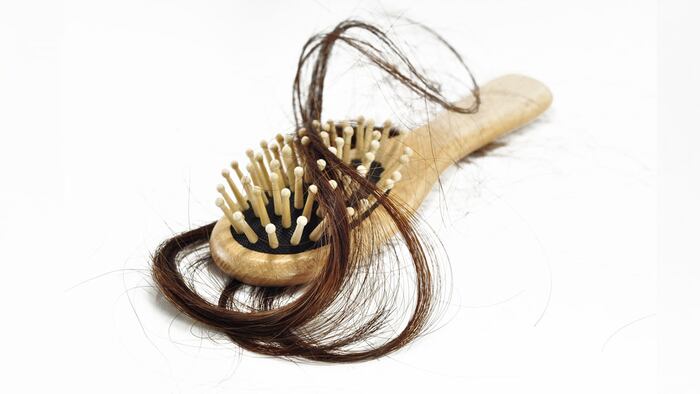 HairLoss_1200x675