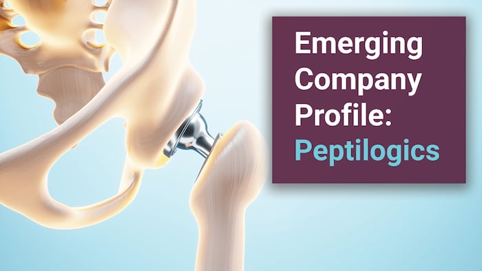 Hip bones with metal, representing joint replacement