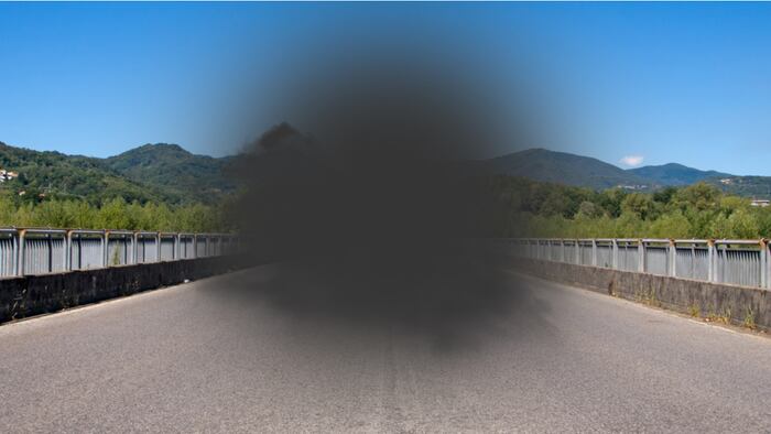 Macular degeneration