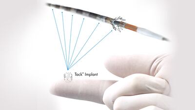 Intact Vascular’s Tack Peripheral Dissection Repair Device Earns PMA