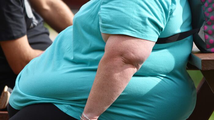 Obese