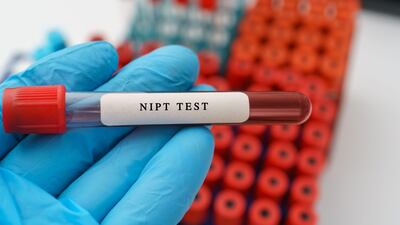 Be Wary Of Test Results From Genetic Prenatal Screenings, FDA Warns