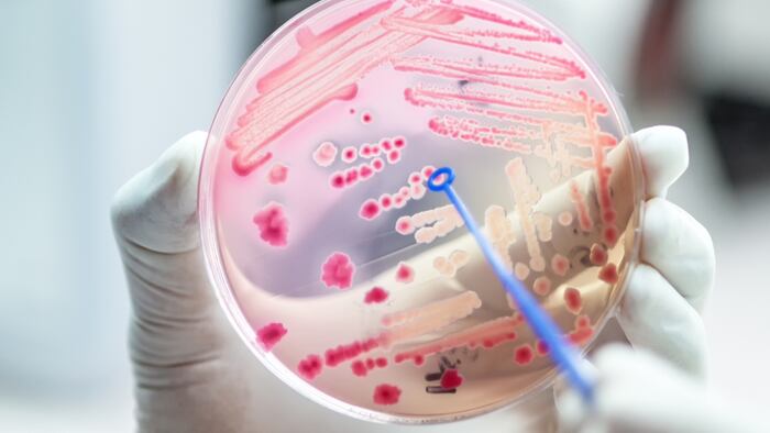 Bacterial_Culture