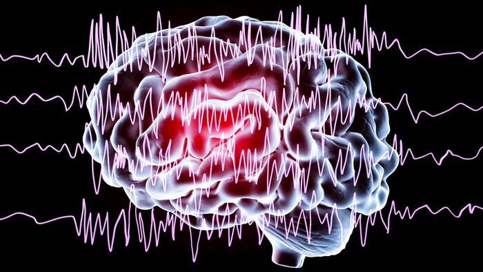 Epilepsy awareness concept. Brain and encephalography in epilepsy patient during seizure attack, 3D illustration in purple color