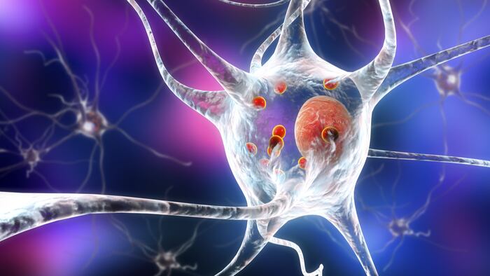 Parkinson's disease