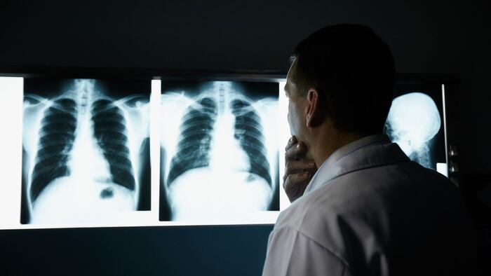 Xrays