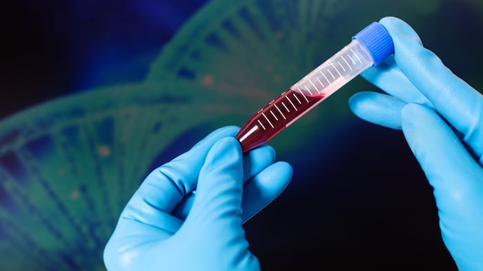 Blood_Test_Vial