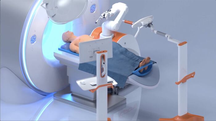 Epione Surgical Robot