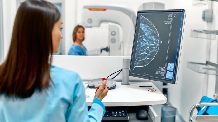 BREAST SCREENING