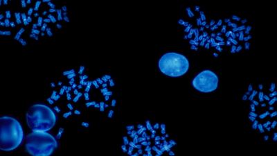 A Test Before An Approved Therapy: Inbiomotion MAFTEST Is Tackling Breast Cancer Metastases