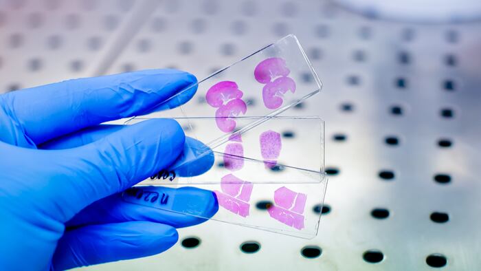 SC1910_Liver-tissue-samples_1052884202_1200.jpg