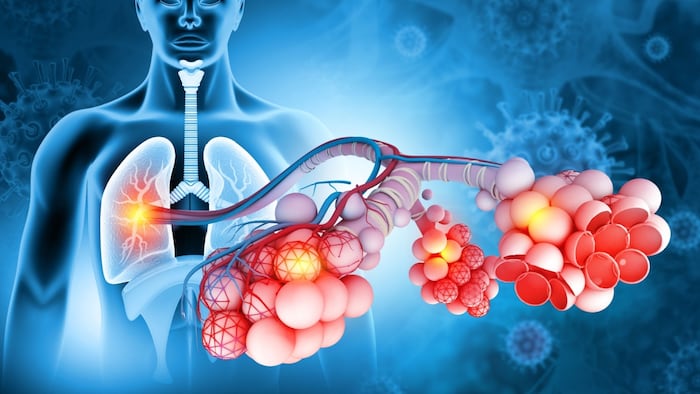 Alveoli