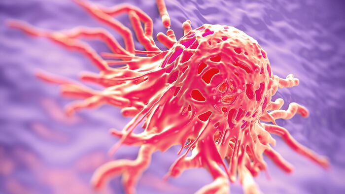 Cervical cancer